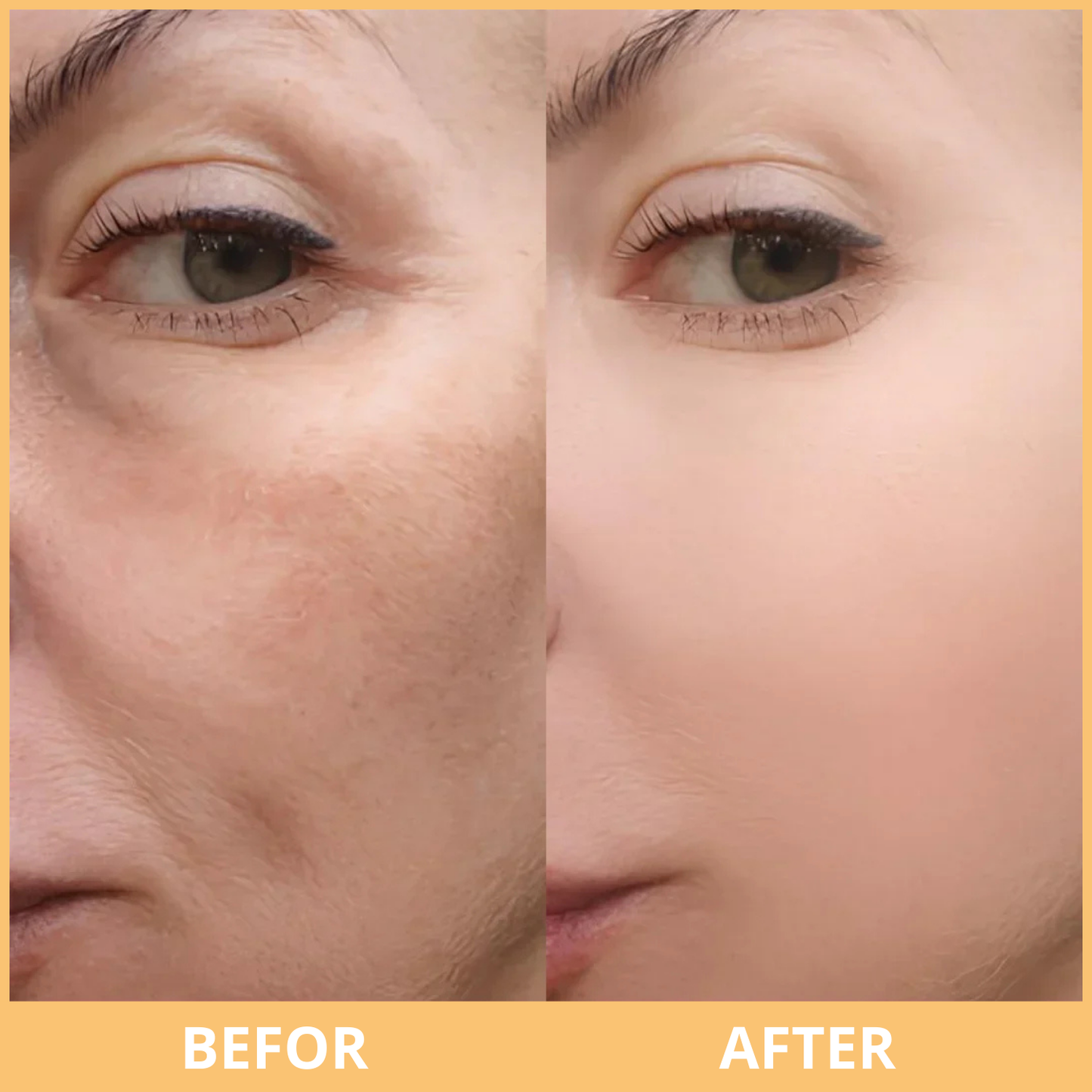 Peel Shot Glow Rice Ampoule Duo